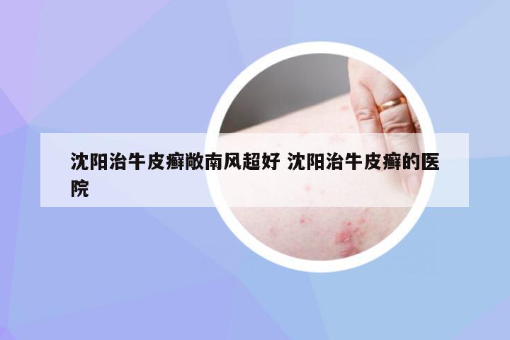 沈阳治牛皮癣敞南风超好 沈阳治牛皮癣的医院