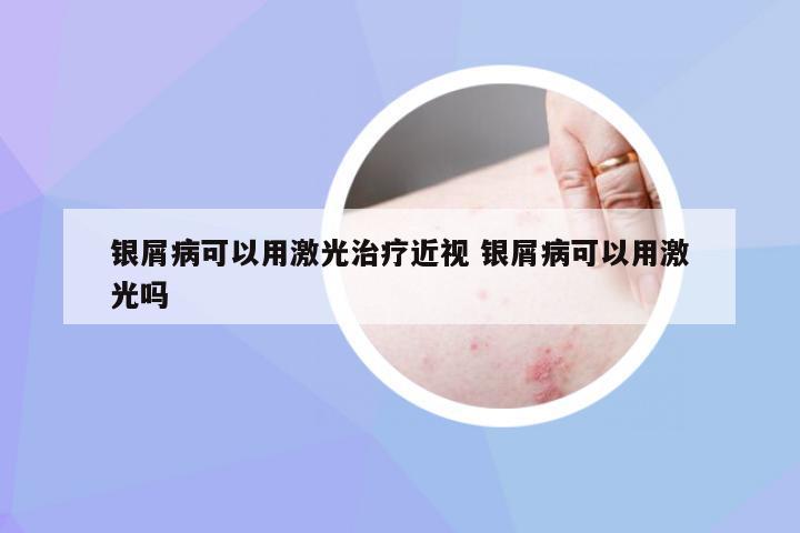 银屑病可以用激光治疗近视 银屑病可以用激光吗