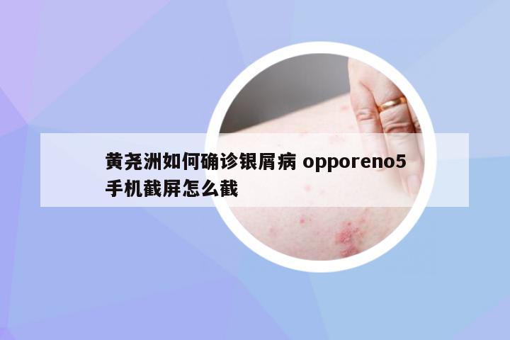 黄尧洲如何确诊银屑病 opporeno5手机截屏怎么截