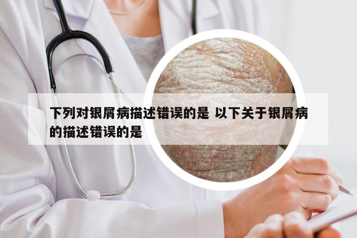 下列对银屑病描述错误的是 以下关于银屑病的描述错误的是