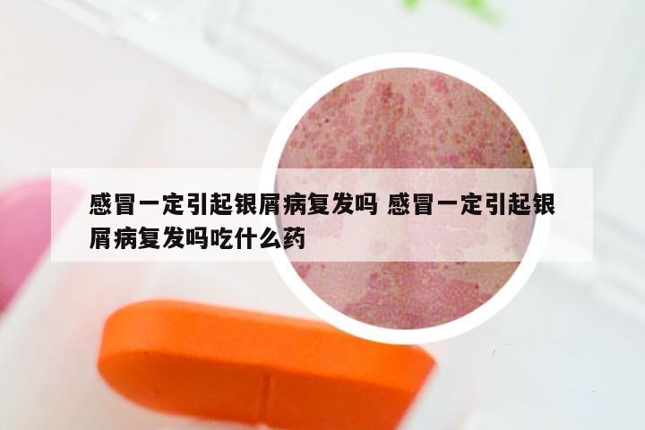感冒一定引起银屑病复发吗 感冒一定引起银屑病复发吗吃什么药