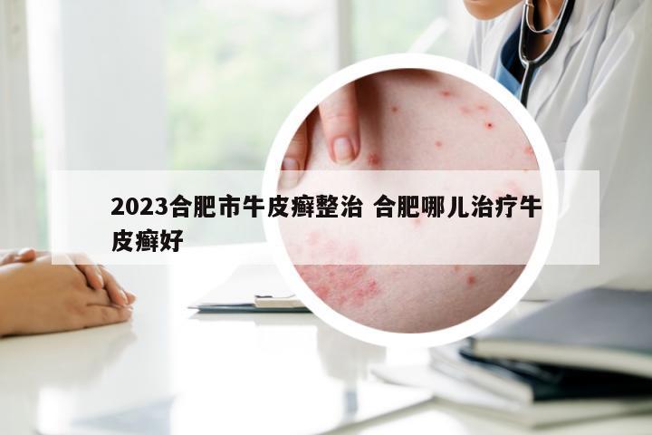 2023合肥市牛皮癣整治 合肥哪儿治疗牛皮癣好
