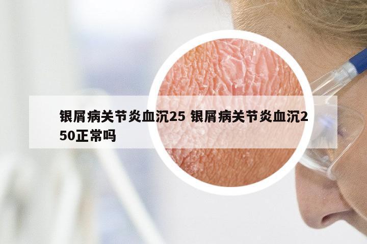 银屑病关节炎血沉25 银屑病关节炎血沉250正常吗