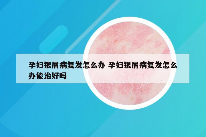孕妇银屑病复发怎么办 孕妇银屑病复发怎么办能治好吗