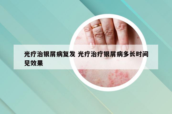 光疗治银屑病复发 光疗治疗银屑病多长时间见效果