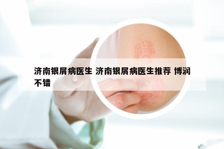 济南银屑病医生 济南银屑病医生推荐 博润不错