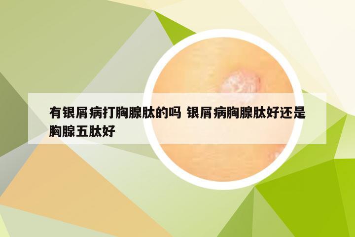 有银屑病打胸腺肽的吗 银屑病胸腺肽好还是胸腺五肽好