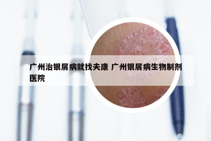 广州治银屑病就找夫康 广州银屑病生物制剂医院