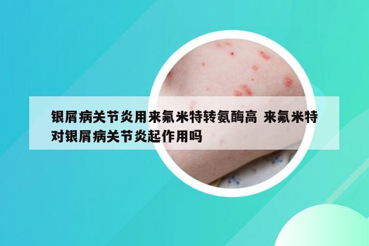 银屑病关节炎用来氟米特转氨酶高 来氟米特对银屑病关节炎起作用吗