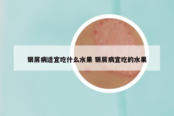 银屑病适宜吃什么水果 银屑病宜吃的水果