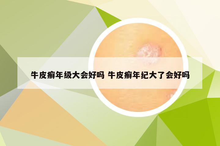 牛皮癣年级大会好吗 牛皮癣年纪大了会好吗