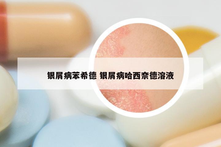 银屑病苯希德 银屑病哈西奈德溶液