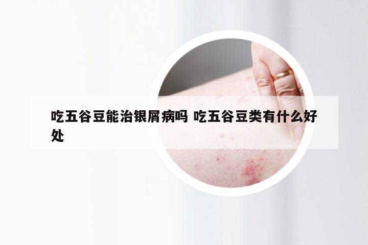 吃五谷豆能治银屑病吗 吃五谷豆类有什么好处