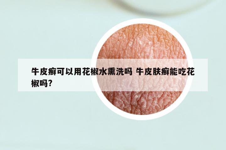 牛皮癣可以用花椒水熏洗吗 牛皮肤癣能吃花椒吗?