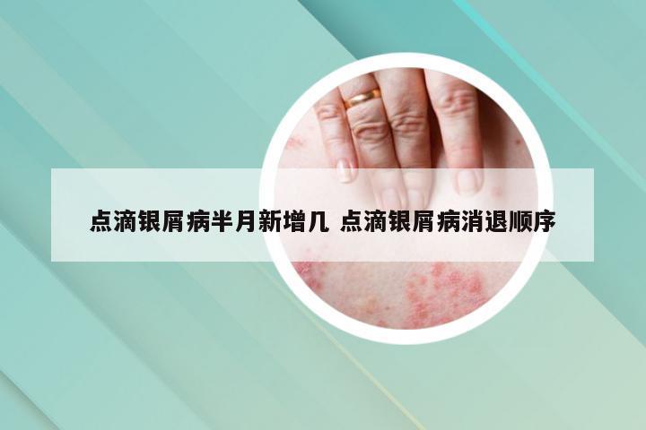 点滴银屑病半月新增几 点滴银屑病消退顺序
