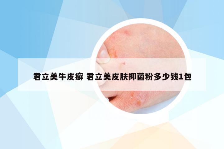 君立美牛皮癣 君立美皮肤抑菌粉多少钱1包