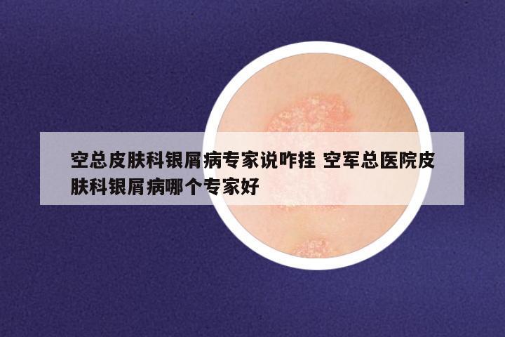 空总皮肤科银屑病专家说咋挂 空军总医院皮肤科银屑病哪个专家好