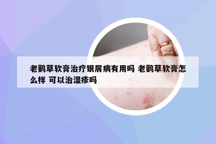 老鹳草软膏治疗银屑病有用吗 老鹳草软膏怎么样 可以治湿疹吗