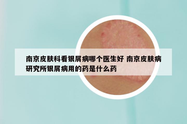 南京皮肤科看银屑病哪个医生好 南京皮肤病研究所银屑病用的药是什么药