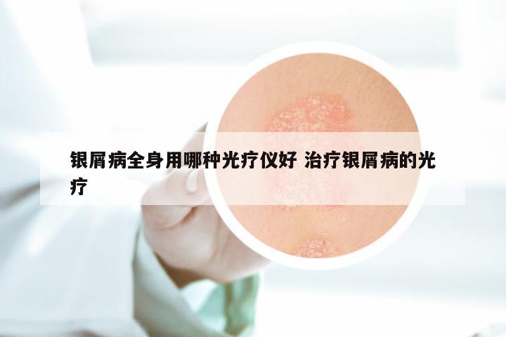 银屑病全身用哪种光疗仪好 治疗银屑病的光疗