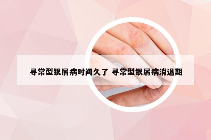 寻常型银屑病时间久了 寻常型银屑病消退期