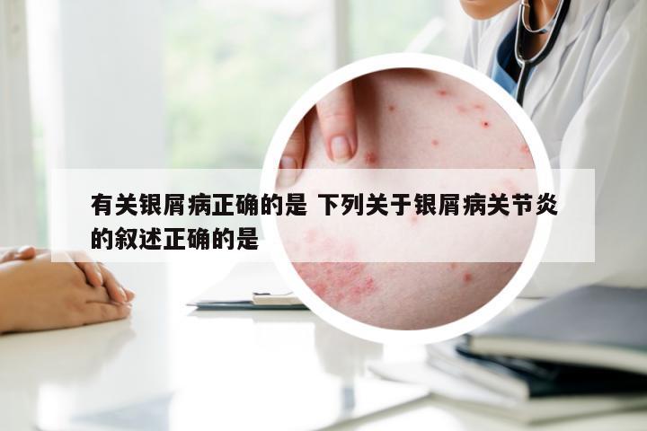 有关银屑病正确的是 下列关于银屑病关节炎的叙述正确的是