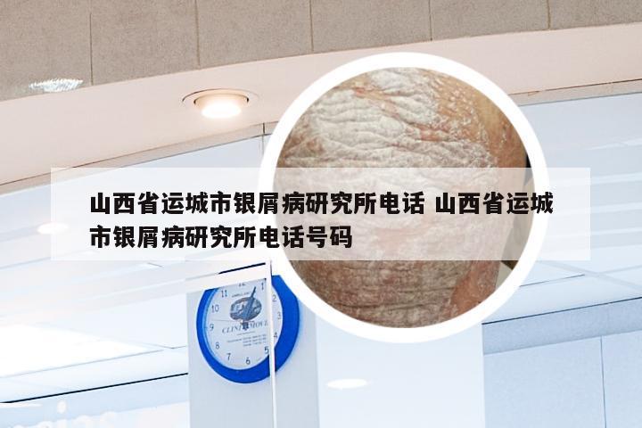 山西省运城市银屑病研究所电话 山西省运城市银屑病研究所电话号码