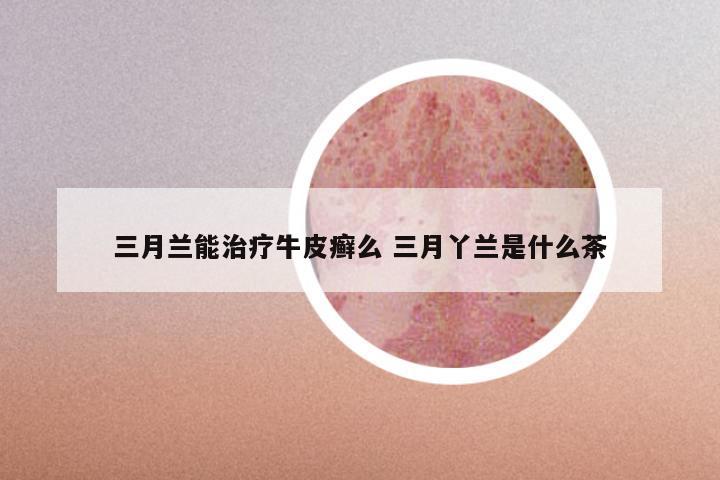 三月兰能治疗牛皮癣么 三月丫兰是什么茶