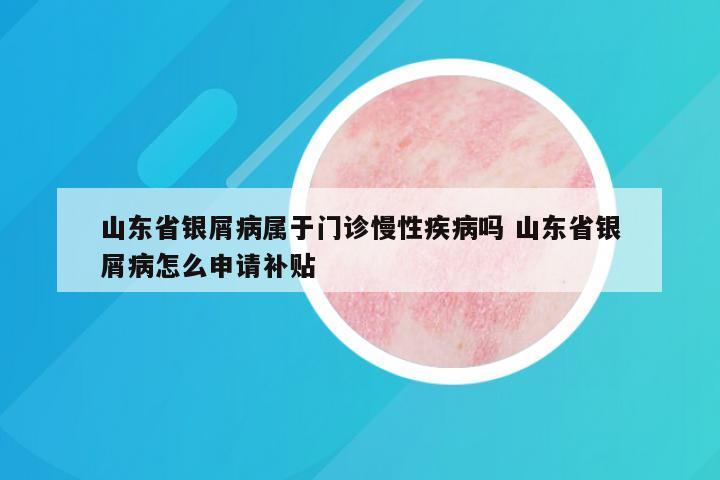 山东省银屑病属于门诊慢性疾病吗 山东省银屑病怎么申请补贴