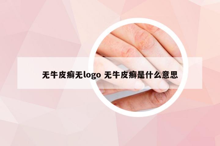 无牛皮癣无logo 无牛皮癣是什么意思
