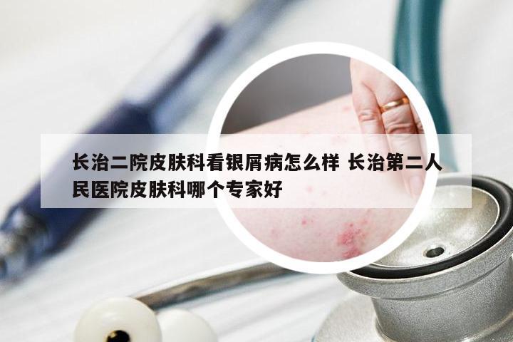 长治二院皮肤科看银屑病怎么样 长治第二人民医院皮肤科哪个专家好