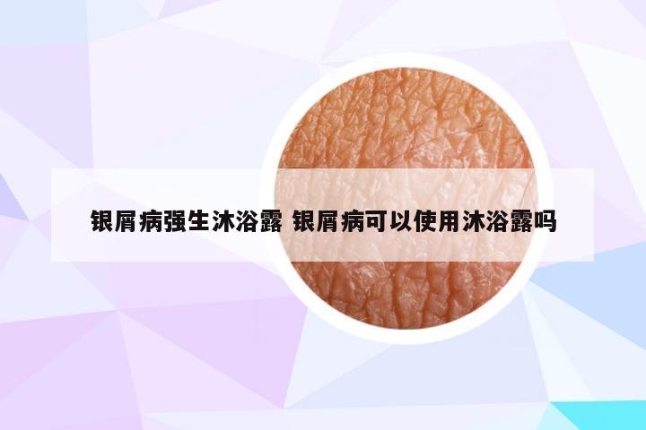 银屑病强生沐浴露 银屑病可以使用沐浴露吗