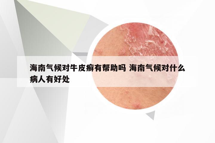 海南气候对牛皮癣有帮助吗 海南气候对什么病人有好处