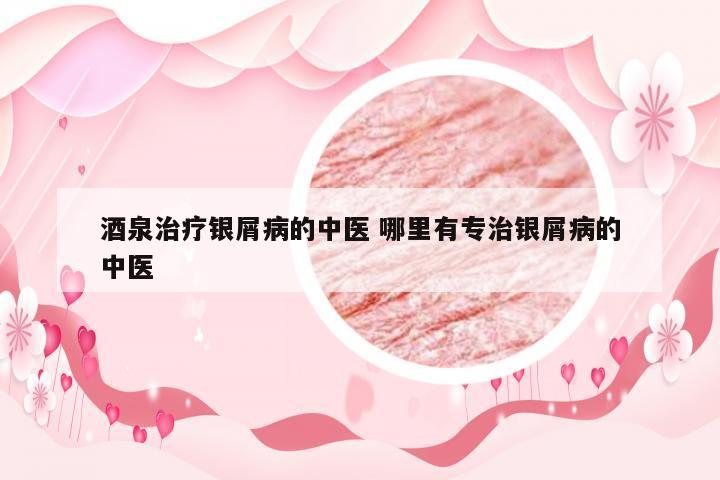 酒泉治疗银屑病的中医 哪里有专治银屑病的中医