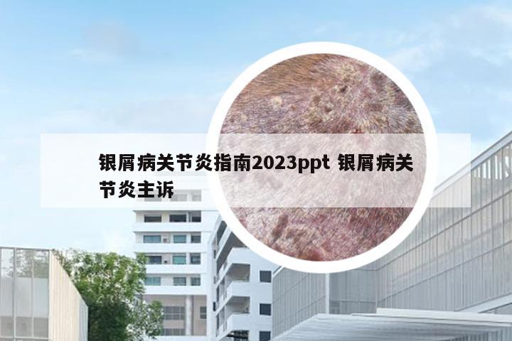 银屑病关节炎指南2023ppt 银屑病关节炎主诉
