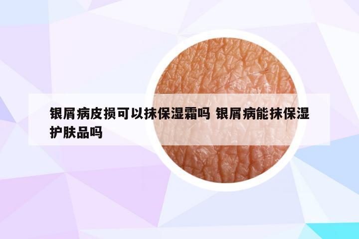 银屑病皮损可以抹保湿霜吗 银屑病能抹保湿护肤品吗