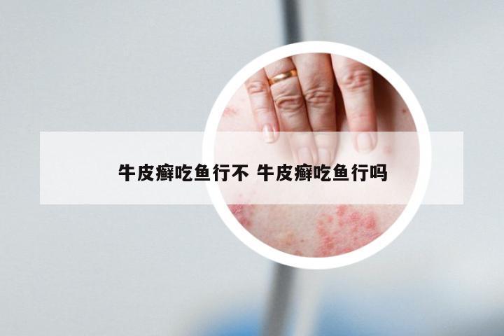 牛皮癣吃鱼行不 牛皮癣吃鱼行吗