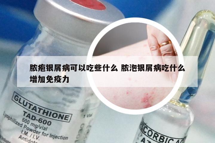 脓疱银屑病可以吃些什么 脓泡银屑病吃什么增加免疫力