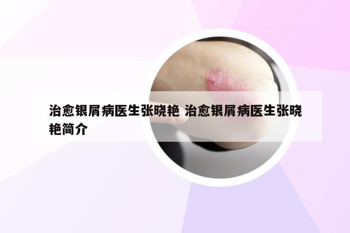 治愈银屑病医生张晓艳 治愈银屑病医生张晓艳简介