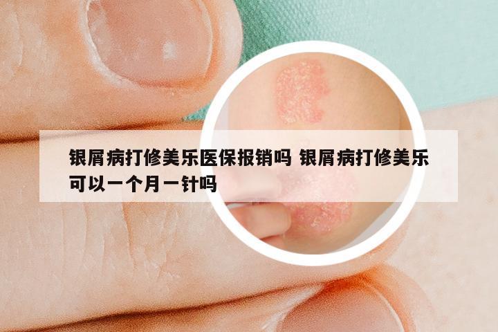 银屑病打修美乐医保报销吗 银屑病打修美乐可以一个月一针吗
