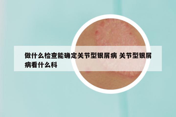 做什么检查能确定关节型银屑病 关节型银屑病看什么科
