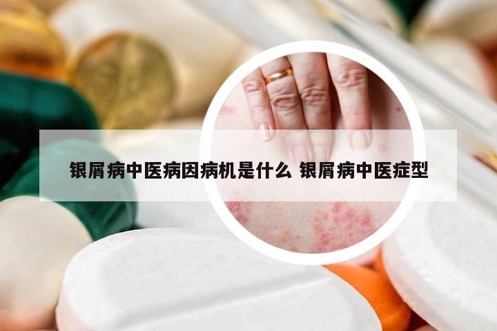 银屑病中医病因病机是什么 银屑病中医症型
