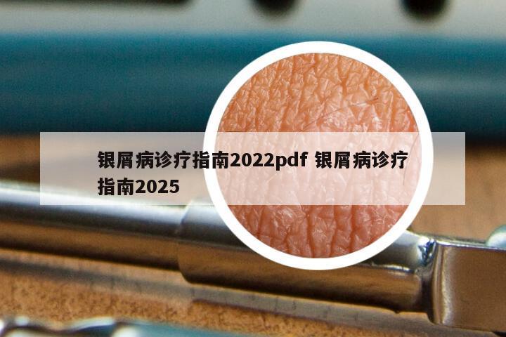 银屑病诊疗指南2022pdf 银屑病诊疗指南2025