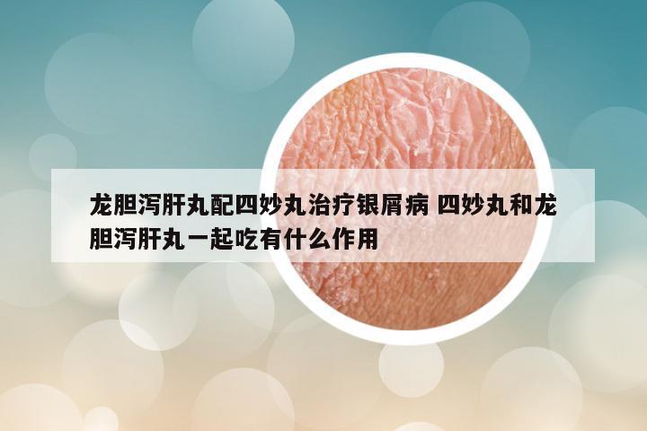 龙胆泻肝丸配四妙丸治疗银屑病 四妙丸和龙胆泻肝丸一起吃有什么作用