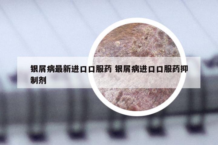 银屑病最新进口口服药 银屑病进口口服药抑制剂