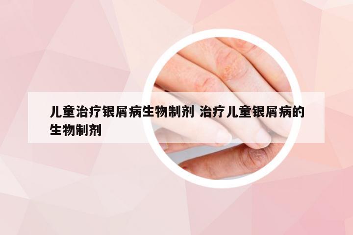 儿童治疗银屑病生物制剂 治疗儿童银屑病的生物制剂