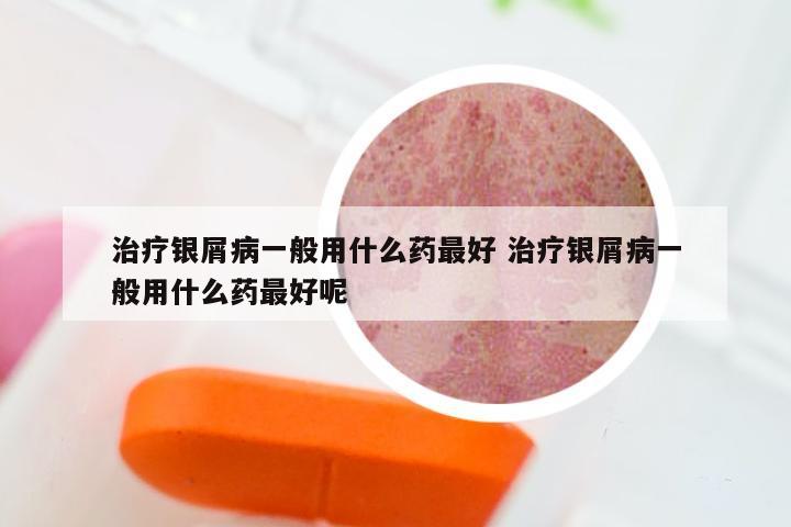 治疗银屑病一般用什么药最好 治疗银屑病一般用什么药最好呢