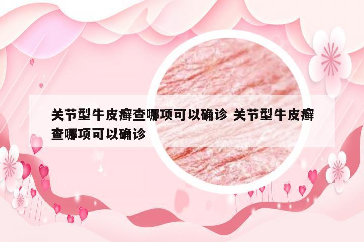 关节型牛皮癣查哪项可以确诊 关节型牛皮癣查哪项可以确诊