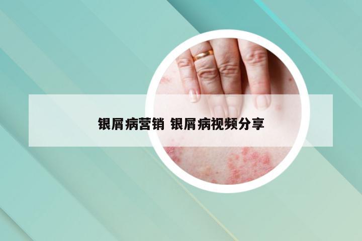 银屑病营销 银屑病视频分享