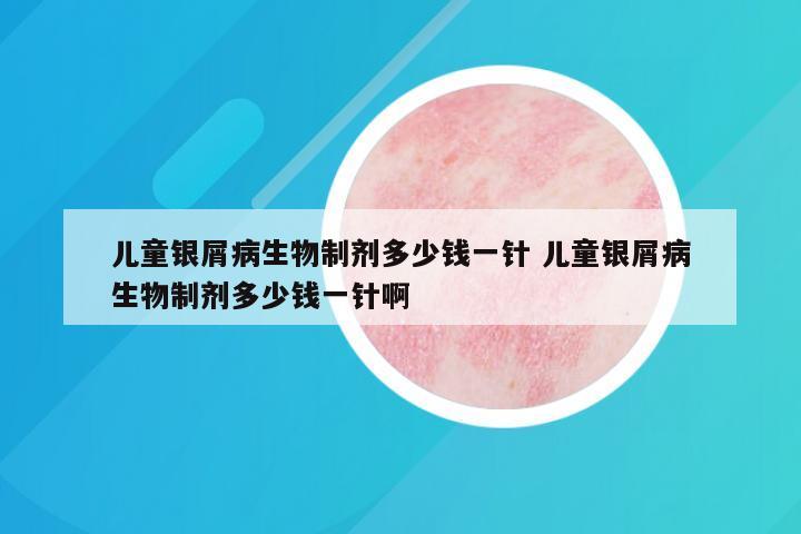 儿童银屑病生物制剂多少钱一针 儿童银屑病生物制剂多少钱一针啊